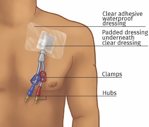 A diagram of a person's chest